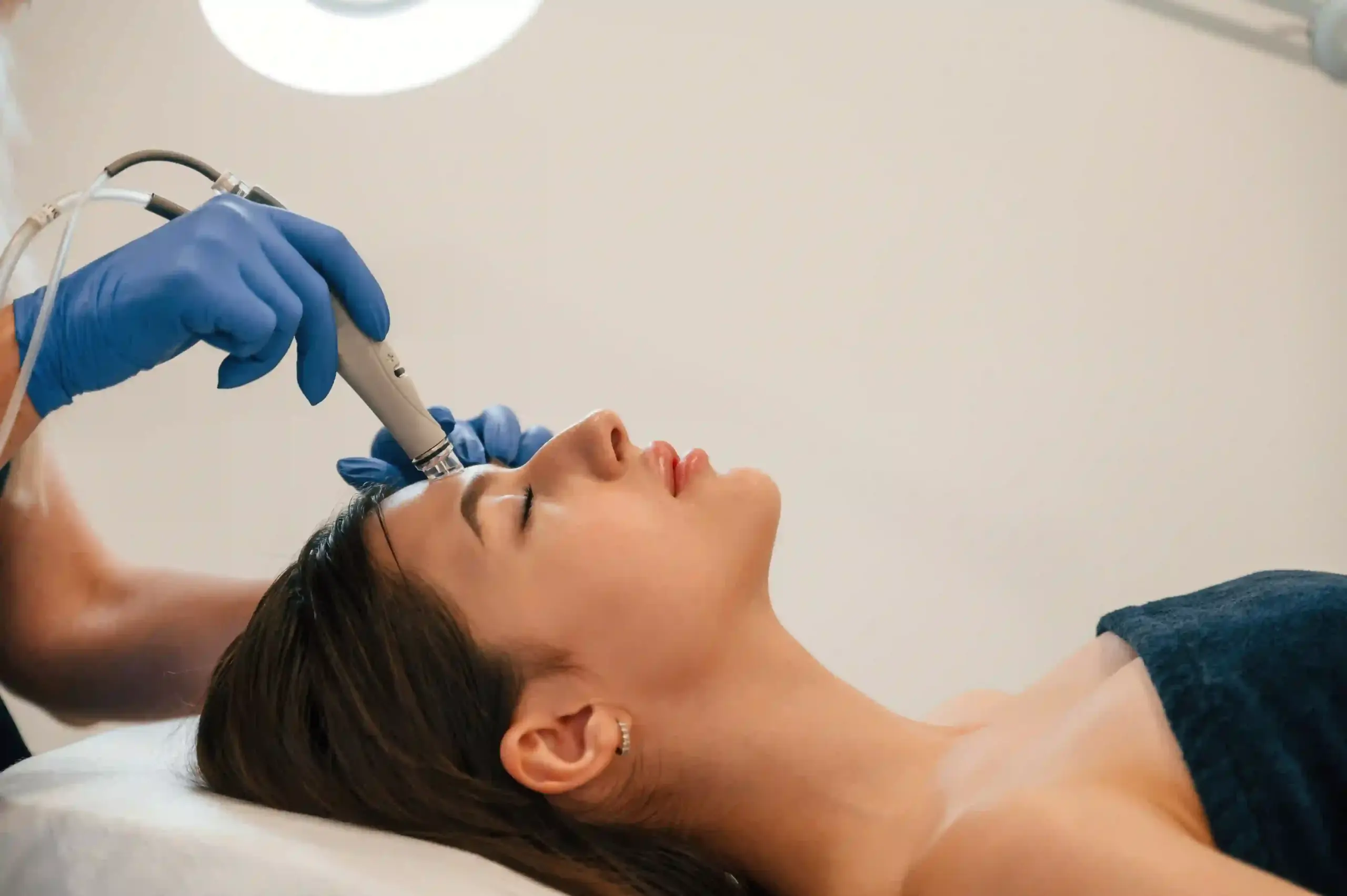Microneedling